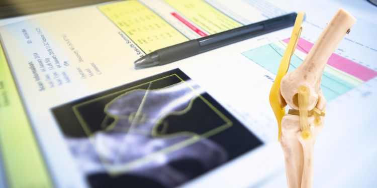 cand se recomanda osteodensiometria (DEXA), osteodensiometrie (DEXA) contraindicatii, 