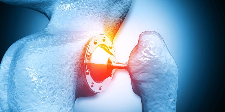pregatirea pentru testul de osteodensiometrie (DEXA), 