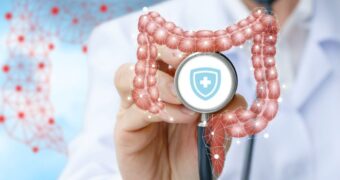 Diverticulita: cauze, simptome, diagnostic, tratament și prevenție