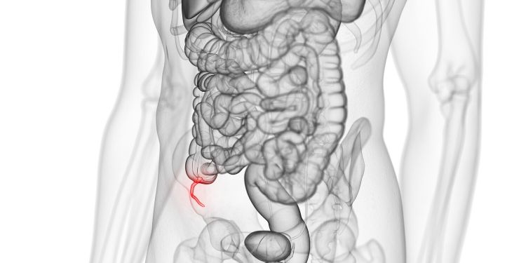 boli greu de diagnosticat, apendice