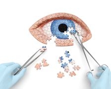 Device-ul eficient in tratarea sindromului de ochi uscat