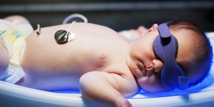 boala hemolitica a nou-nascutului, ce este boala hemolitica a nou-nascutului, boala hemolitica a nou-nascutului simptome, boala hemolitica a nou-nascutului diagnostic,  cum se trateaza boala hemolitica a nou-nascutului, boala hemolitica a nou-nascutului metode de prevenire, 