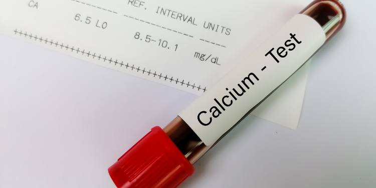 hipocalcemie, cauze hipocalcemie, simptome hipocalcemie, remedii hipocalcemie, tratament hipocalcemie, riscuri hipocalcemie, surse de calciu, 