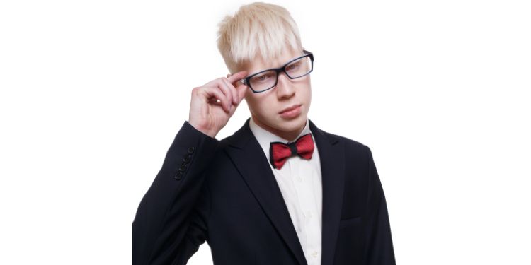albinism simptome dermatologice, albinism simptome oftalmologice, albinism diagnostic, albinism preventie,