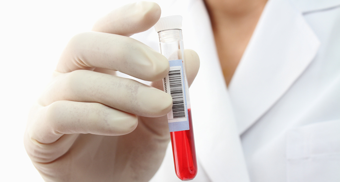 Vsh Crescut Sau Scăzut Ce Boli Poate Ascunde Csid Ce Se Intamplă Doctore