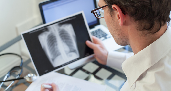 Tuberculoza pulmonara - cum poate fi prevenita