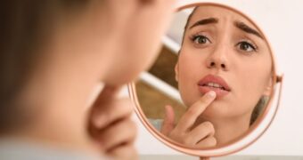 Cum prevenim apariția herpesului bucal? 7 sfaturi de ajutor