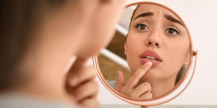 Cum prevenim apariția herpesului bucal? 7 sfaturi de ajutor
