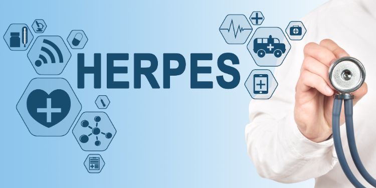 ce este herpesul bucal, herpes bucal simptome, cauze herpes bucal, factori deris pentru herpesul bucal, diagnostic herpes bucal, sfaturi pentru a preveni aparitia herpesului bucal, 