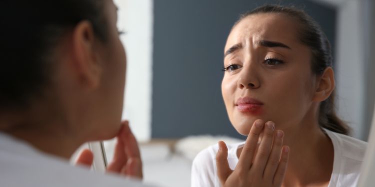 ce este herpesul bucal, herpes bucal simptome, cauze herpes bucal, factori de risc pentru herpesul bucal, diagnostic herpes bucal, sfaturi pentru a preveni aparitia herpesului bucal, 