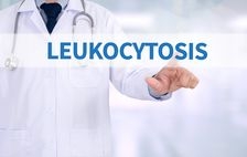 Leucocitoza: cauze, simptome, tratament