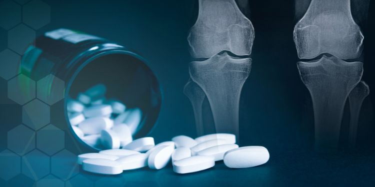 glucozamină și condroitină