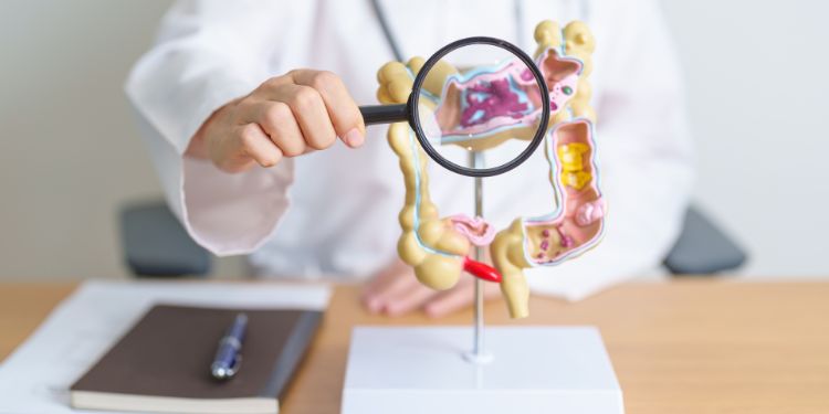colita ulcerativa, cauze colita ulcerativa, diagnostic colita ulcerativa, management colita ulcerativa, colita ulcerativa sfaturi,