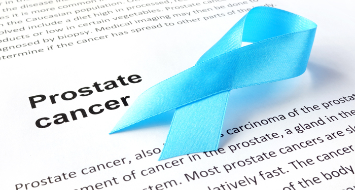 Cancerul de prostata avansat: optiuni de tratament