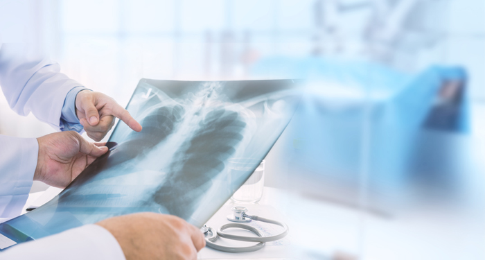 Investigatii medicale in cancerul pulmonar