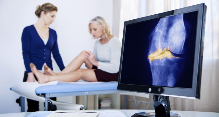 Obiceiuri gresite care agraveaza osteoartrita
