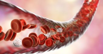 Trombocitoza: cauze si diagnostic