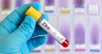 Virusul Zika ar putea ajuta la vindecarea tumorilor cerebrale