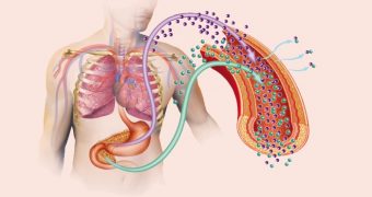 Stiti de ce fel de diabet suferiti? Se pare ca diabetul tip 3c este diagnosticat gresit, ca diabet tip 2