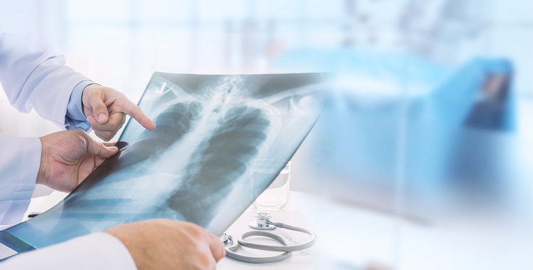 Emfizemul pulmonar: simptome si tratament