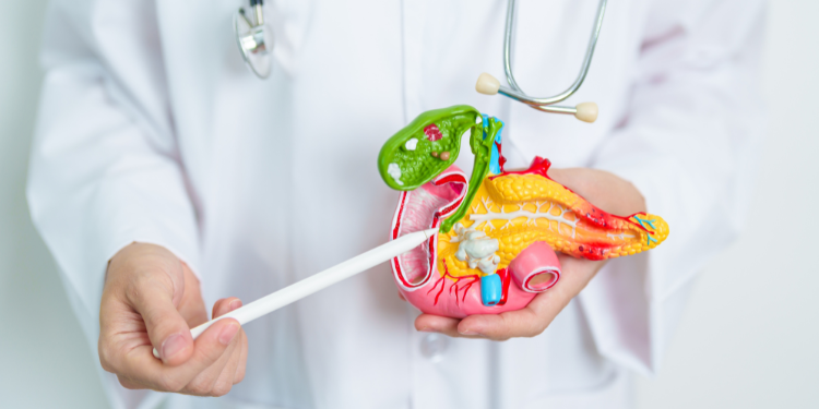 pancreatita acuta, pancreatita necrozanta, cauze pancreatita necrozanta, simptome pancreatita necrozanta, tratament pancreatita necrozanta, diagnostic pancreatita necrozanta, 