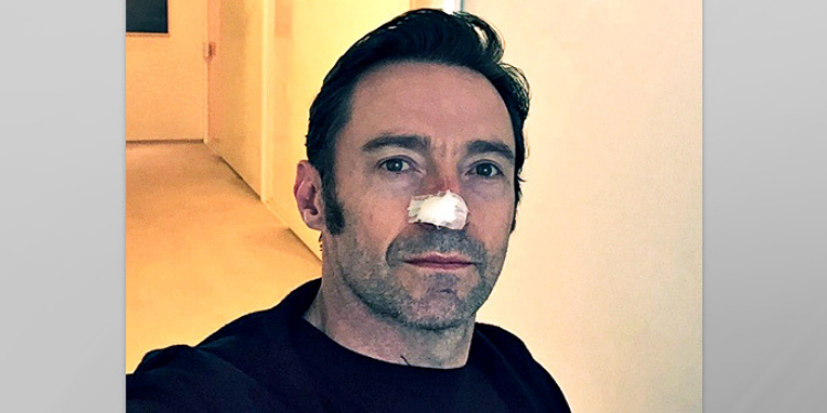 Hugh Jackman