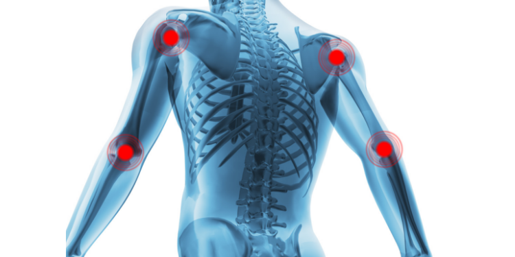 ce este folosit pentru durerile articulare Ameliorează durerea la nivelul coloanei vertebrale toracice