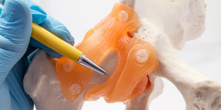 tratamentul conservator al articulației șoldului ameliorează pastilele pentru durerea genunchiului