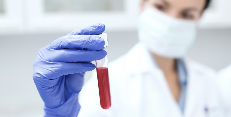 science, chemistry, biology, medicine and people concept - close up of young female scientist holding test tube with blood sample making research in clinical laboratory