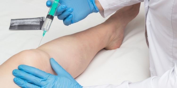 răsuci articulațiile genunchiului și cotului artroza în tratamentul călcâiului
