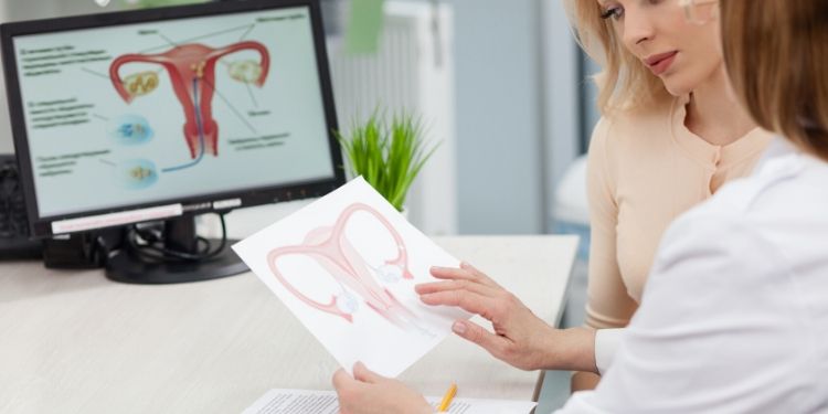 Sindromul ovarelor polichistice: manifestări şi complicaţii