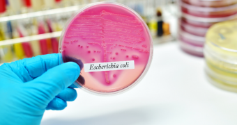 Igiena precară a mâinilor favorizează răspândirea E. coli