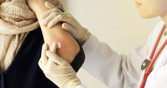 Peste media europeană! 5% dintre români suferă de psoriazis