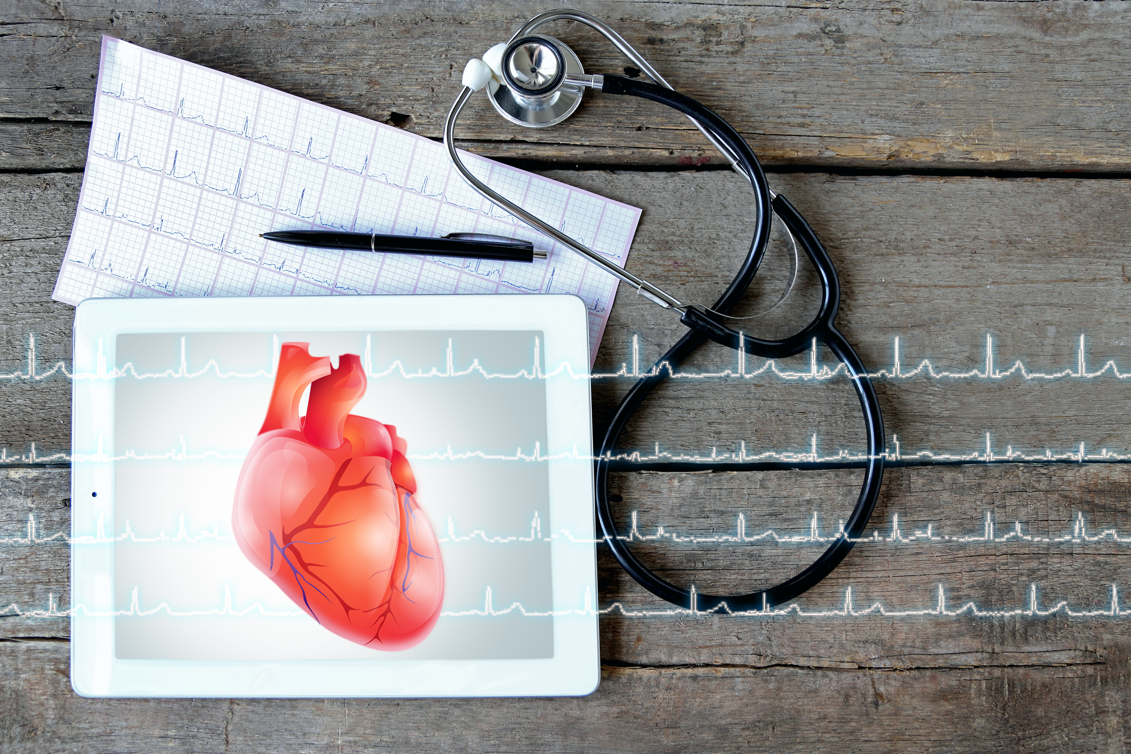 Aritmiile cardiace: când inima îşi pierde ritmul
