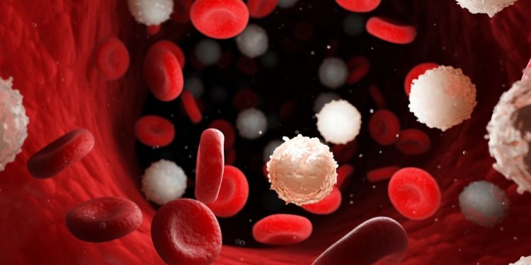 A fost descoperit un tratament inovator pentru leucemia mieloidă cronică
