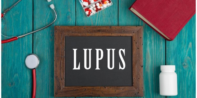 lupus, tratament lupus, lupus eritematos sistemic,