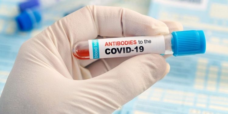 Anticorpii anti-COVID-19 dispar după trei luni din organism