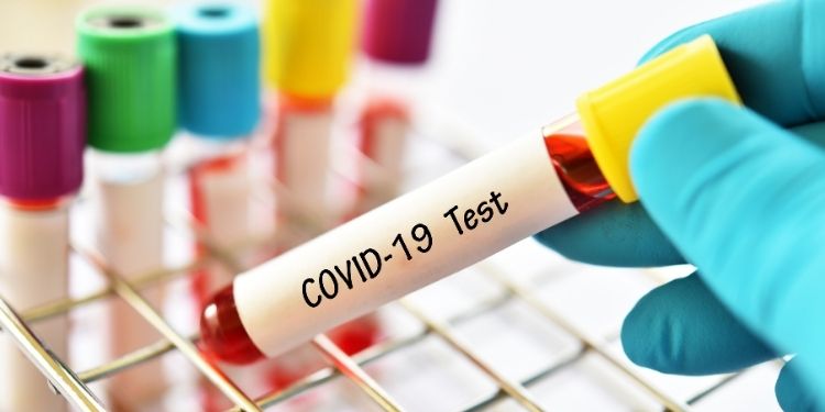 COVID-19 fără să vă daţi seama, COVID-19, anticorpi, dificultăți de respirație, virus, virusul SARS-CoV-2, SARS-CoV-2,