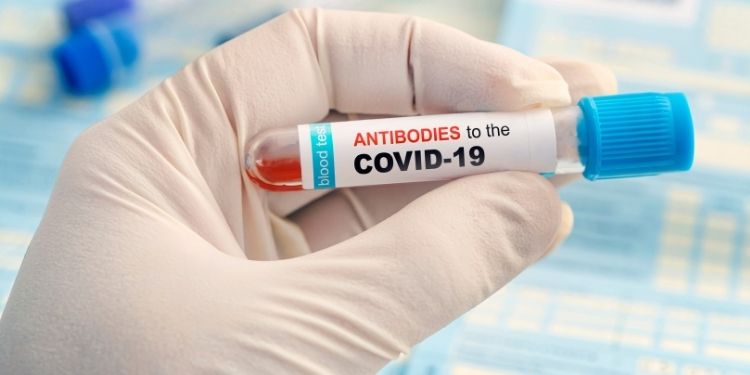 COVID-19, autoanticorpi, anticorpi, autoimun,