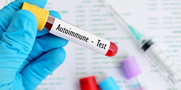 boli imunitare și articulații medicament eficient pentru tratamentul artrozei articulațiilor