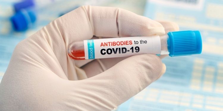 testare COVID-19, metode de detectare a infecţiei cu SARS-CoV-2, teste RT-PCR, anticorpi tip IgG, testele serologice, coronavirus, virus,