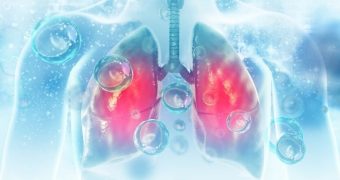 Legătura dintre cheagurile de sânge şi cancerul pulmonar