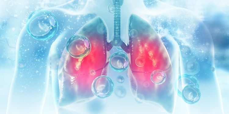 Legătura dintre cheagurile de sânge şi cancerul pulmonar