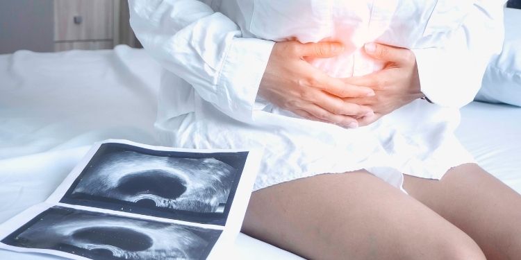 De ce Endometrioza provoacă creșterea în greutate și cum pot să o opresc? | Sănătate | June 