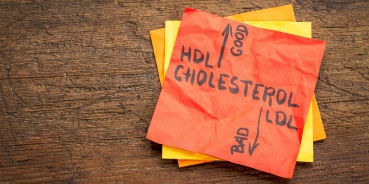 colesterolul crescut, LDL-colesterol, HDL-colesterol, colesterol, ateroame, plăci de colesterol, tensiunea arterială, AVC,