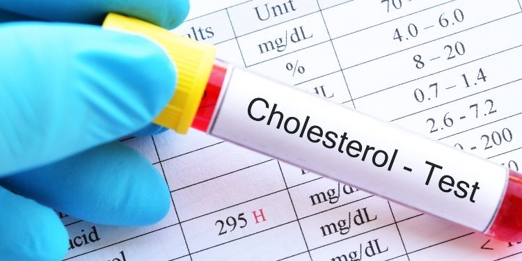 mit colesterol
