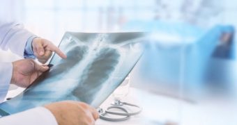 Pneumonie virală sau pneumonie bacteriană? Asemănări şi diferenţe