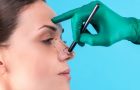 Rinoplastia, intervenţia care rezolvă multe probleme