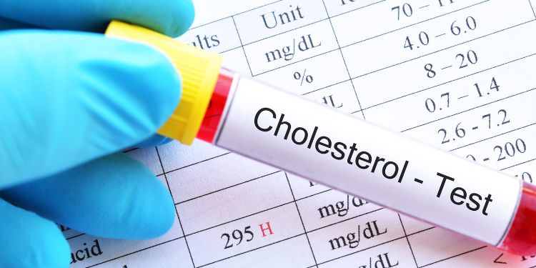 colesterol,