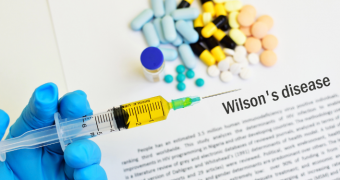 Ce este boala Wilson? Cauze, simptome și tratament